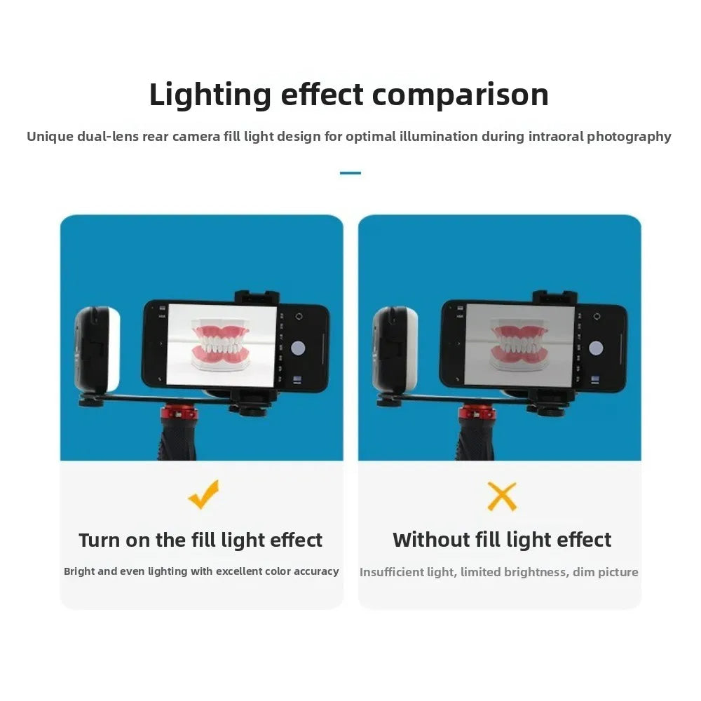 Dental Photography Light, Bluetooth LED Flash for Smartphone, Oral Cavity Exam Teeth Whitening Shooting, Portable Fill Light Kit