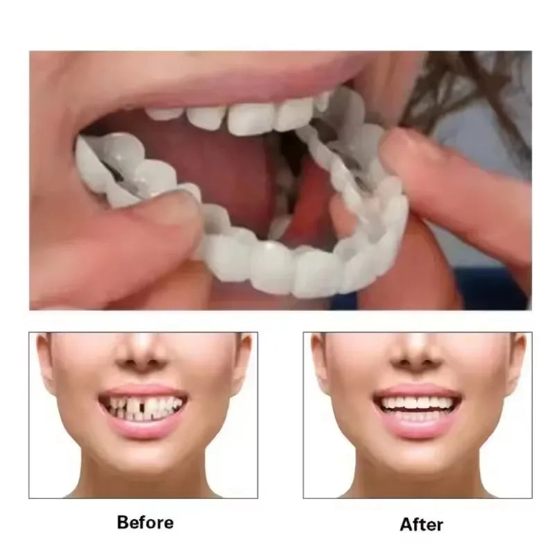 Teeth Veneers Whitening Dentures Braces Temporary False Teeth Cover Perfect Smile Comfortable Fit Denture Kit