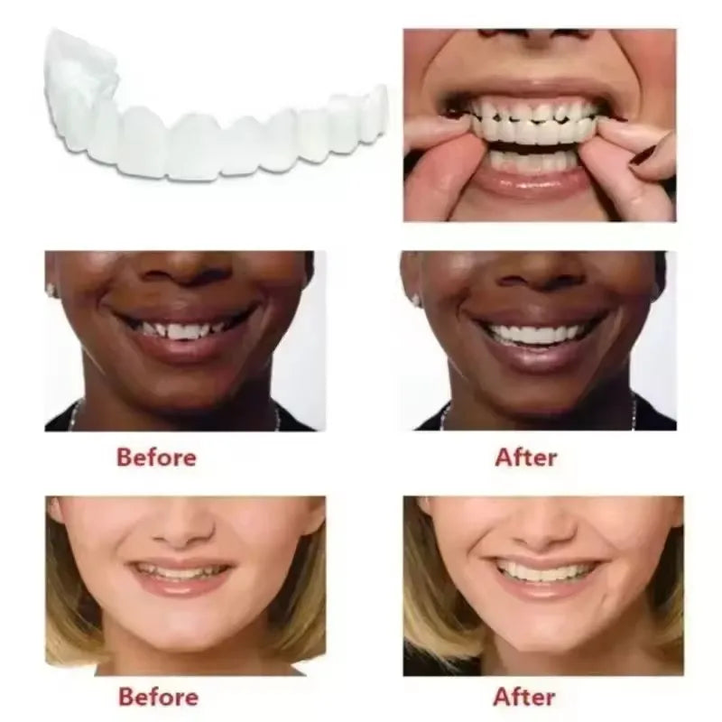 Teeth Veneers Whitening Dentures Braces Temporary False Teeth Cover Perfect Smile Comfortable Fit Denture Kit