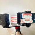 Dental Photography Light, Bluetooth LED Flash for Smartphone, Oral Cavity Exam Teeth Whitening Shooting, Portable Fill Light Kit